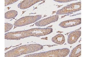 IHC analysis of DAZAP1 using anti-DAZAP1 antibody (ABIN6719309).