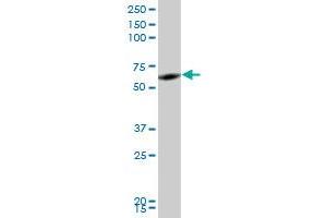 RNF2 monoclonal antibody (M05), clone 2B6. (RNF2 antibody  (AA 192-290))