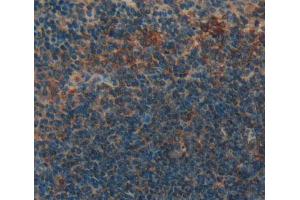 Used in DAB staining on fromalin fixed paraffin- embedded Kidney tissue (GRPR antibody  (AA 1-116))