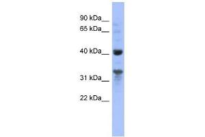 MRPL37 antibody used at 1 ug/ml to detect target protein. (MRPL37 antibody  (N-Term))