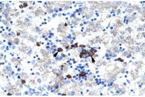 Human kidney; ABT1 antibody - middle region in Human kidney cells using Immunohistochemistry (Activator of Basal Transcription 1 antibody  (Middle Region))