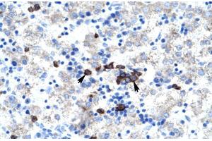 Human kidney; ABT1 antibody - middle region in Human kidney cells using Immunohistochemistry