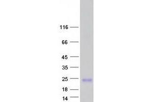 Small Proline-Rich Protein 2B (SPRR2B) protein (Myc-DYKDDDDK Tag)