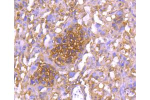 Paraformaldehyde-fixed, paraffin embedded mouse placenta section, Antigen retrieval by boiling in sodium citrate buffer (pH6. (YWHAE antibody)