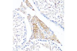 Immunohistochemistry of paraffin-embedded mouse testis leydig using Fibronectin antibody (ABIN7267194) at dilution of 1:100 (40x lens). (Fibronectin 1 antibody  (AA 2200-2355))
