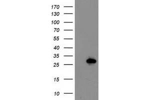 HEK293T cells were transfected with the pCMV6-ENTRY control (Left lane) or pCMV6-ENTRY LXN (Right lane) cDNA for 48 hrs and lysed. (Latexin antibody)