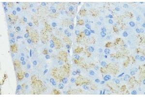 Immunohistochemistry of paraffin-embedded Mouse pancreas using SOD3 Polyclonal Antibody at dilution of 1:100 (40x lens). (SOD3 antibody)