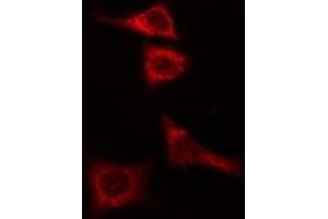 ABIN6274987 staining COLO205 cells by IF/ICC. (CEP135 antibody  (C-Term))