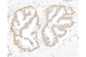 Immunohistochemistry (IHC) image for anti-Replication Protein A2, 32kDa (RPA2) (pSer4), (pSer8) antibody (ABIN7449013) (RPA2 antibody  (pSer4, pSer8))