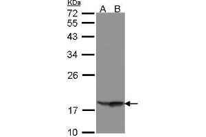 WB Image Sample(30 μg of whole cell lysate) A:Raji, B:MOLT4, 12% SDS PAGE antibody diluted at 1:1000