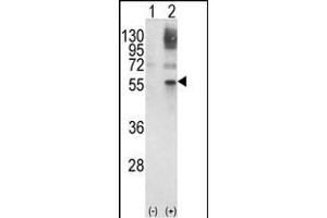 Western blot analysis of GATA2 (arrow) using rabbit polyclonal GATA2 Antibody (Center) (ABIN652243 and ABIN2841006). (GATA2 antibody  (AA 262-288))