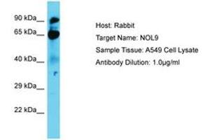 Image no. 1 for anti-Nucleolar Protein 9 (NOL9) (AA 74-123) antibody (ABIN6750676) (NOL9 antibody  (AA 74-123))