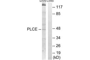 Western Blotting (WB) image for anti-1-Acylglycerol-3-Phosphate O-Acyltransferase 5 (Lysophosphatidic Acid Acyltransferase, Epsilon) (AGPAT5) (Internal Region) antibody (ABIN1850516) (AGPAT5 antibody  (Internal Region))