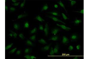 Image no. 2 for anti-Nucleoporin 133kDa (NUP133) (AA 1069-1156) antibody (ABIN599269) (NUP133 antibody  (AA 1069-1156))
