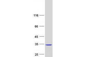 Validation with Western Blot (UROS Protein (Myc-DYKDDDDK Tag))