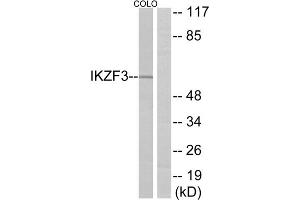 Western blot analysis of extracts from COLO cells, using IKZF3 antibody.