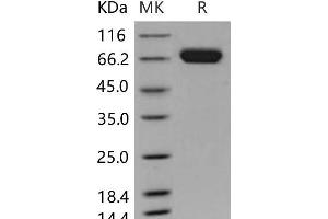 EPH Receptor A7 Protein (EPHA7) (His tag)