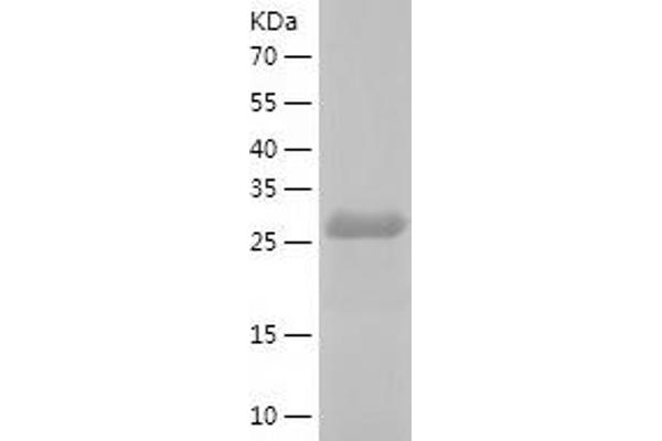 DNAJC27 Protein (AA 1-273) (His tag)