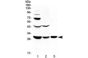 Western blot testing of 1) rat liver, 2) rat kidney and 3) mouse kidney lysate with TL1A antibody at 0.