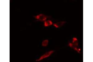 ABIN6274466 staining HuvEc cells by IF/ICC. (MKL1 antibody  (N-Term))