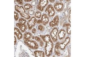 Immunohistochemical staining of human kidney with IL22RA2 polyclonal antibody  shows moderate cytoplasmic staining and luminal membrane positivity in tubules. (IL22RA2 antibody)