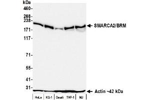 Western Blotting (WB) image for anti-SWI/SNF Related, Matrix Associated, Actin Dependent Regulator of Chromatin, Subfamily A, Member 2 (SMARCA2) (AA 1325-1375) antibody (ABIN7795709)