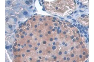 Immunohistochemistry (IHC) image for anti-Synaptosomal-Associated Protein, 23kDa (SNAP23) (AA 1-210) antibody (ABIN7444226)