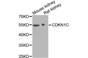 Western blot analysis of extracts of various cell lines, using CDKN1C antibody (ABIN1871758) at 1:1000 dilution. (CDKN1C antibody)