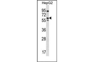 Western blot analysis of ERRFI1 / MIG6  Antibody  in HepG2 cell line lysates (35ug/lane). (ERRFI1 antibody  (Middle Region))