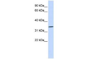 RHCE antibody used at 1 ug/ml to detect target protein. (RHCE antibody  (N-Term))