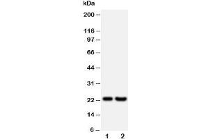 Western blot testing of FGF9 antibody and Lane 1:  rat brain;  2: HeLa;  Predicted size: 23KD;  Observed size: 23KD (FGF9 antibody  (Middle Region))