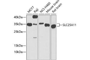Western blot analysis of extracts of various cell lines, using SLC25 antibody (ABIN6132660, ABIN6147903, ABIN6147904 and ABIN6224187) at 1:1000 dilution. (SLC25A11 antibody  (AA 1-314))