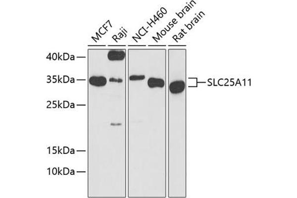 SLC25A11 antibody  (AA 1-314)