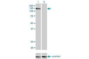 Western blot analysis of TMEM1 over-expressed 293 cell line, cotransfected with TMEM1 Validated Chimera RNAi (Lane 2) or non-transfected control (Lane 1). (TRAPPC10 antibody  (AA 1162-1257))
