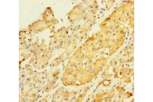 Immunohistochemistry of paraffin-embedded human pancreatic tissue using ABIN7176608 at dilution of 1:100 (ZKSCAN2 antibody  (AA 1-300))