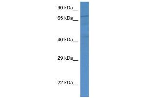 WB Suggested Anti-FAF1 AntibodyTitration: 1. (FAF1 antibody  (Middle Region))