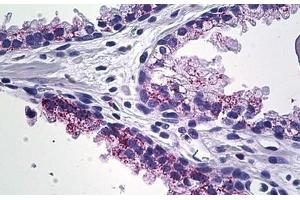 Human Prostate: Formalin-Fixed, Paraffin-Embedded (FFPE) (MMP23B antibody  (C-Term))