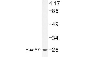 Image no. 1 for anti-Homeobox A7 (HOXA7) antibody (ABIN272304) (HOXA7 antibody)