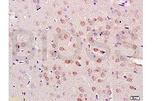 Formalin-fixed and paraffin embedded rat brain tissue labeled with Anti-LLGL1/2 Polyclonal Antibody, Unconjugated (ABIN761966) at 1:200 followed by conjugation to the secondary antibody and DAB staining