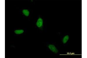 Immunofluorescence of  purified  MaxPab antibody to ZSCAN5 on HeLa cell. (ZSCAN5A antibody  (AA 1-496))