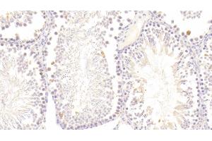Detection of GPX5 in Rat Testis Tissue using Polyclonal Antibody to Glutathione Peroxidase 5 (GPX5) (GPX5 antibody  (AA 22-221))