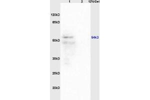 Lane 1: mouse brain lysates Lane 2: mouse heart lysates probed with Anti Iroquois homeobox protein 3 Polyclonal Antibody, Unconjugated (ABIN872921) at 1:200 in 4 °C. (IRX3 antibody  (AA 401-501))