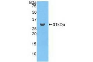 Detection of Recombinant FCN3, Human using Polyclonal Antibody to Ficolin 3 (FCN3) (FCN3 antibody  (AA 34-297))
