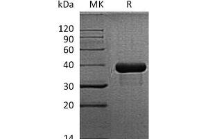 Western Blotting (WB) image for Secreted Protein, Acidic, Cysteine-Rich (Osteonectin) (SPARC) protein (His tag) (ABIN7320777)
