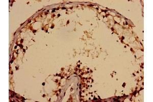 Immunohistochemistry analysis of human testis tissue using ABIN7171638 at dilution of 1:100 (TBC1D31 antibody  (AA 662-1001))