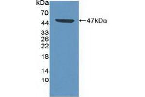 Detection of Recombinant CDK8, Human using Polyclonal Antibody to Cyclin Dependent Kinase 8 (CDK8) (CDK8 antibody  (AA 21-392))