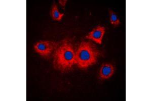 Immunofluorescent analysis of SLK staining in MCF7 cells.