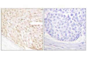 Immunohistochemistry (IHC) image for anti-P18 INK (C-Term) antibody (ABIN1848714) (P18 INK antibody  (C-Term))