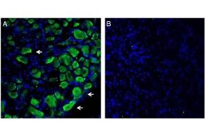Expression of Plexin-C1 in in rat dorsal root ganglion. (Plexin C1 antibody  (Extracellular, N-Term))