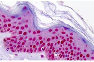 Human Skin: Formalin-Fixed, Paraffin-Embedded (FFPE) (Aryl Hydrocarbon Receptor antibody  (AA 2-51))